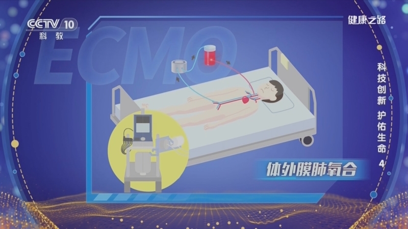 健康之路 《健康之路》 20240221 科技创新 护佑生命4