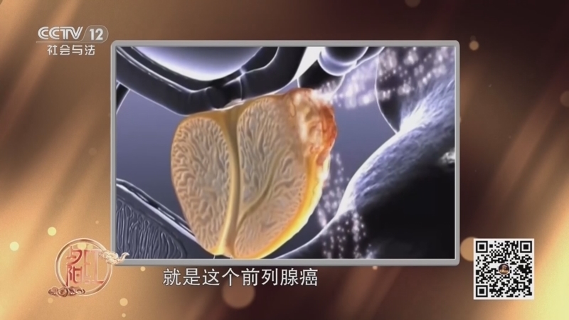 夕阳红 《夕阳红》 20260128 关于癌症的科学回答（1）