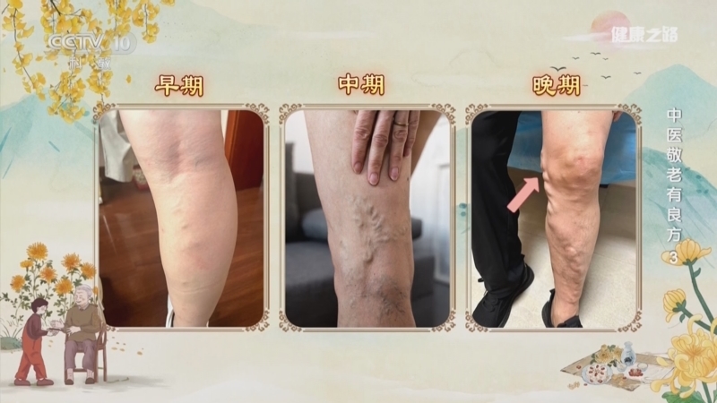 《健康之路》 20251031 中医敬老有良方 3