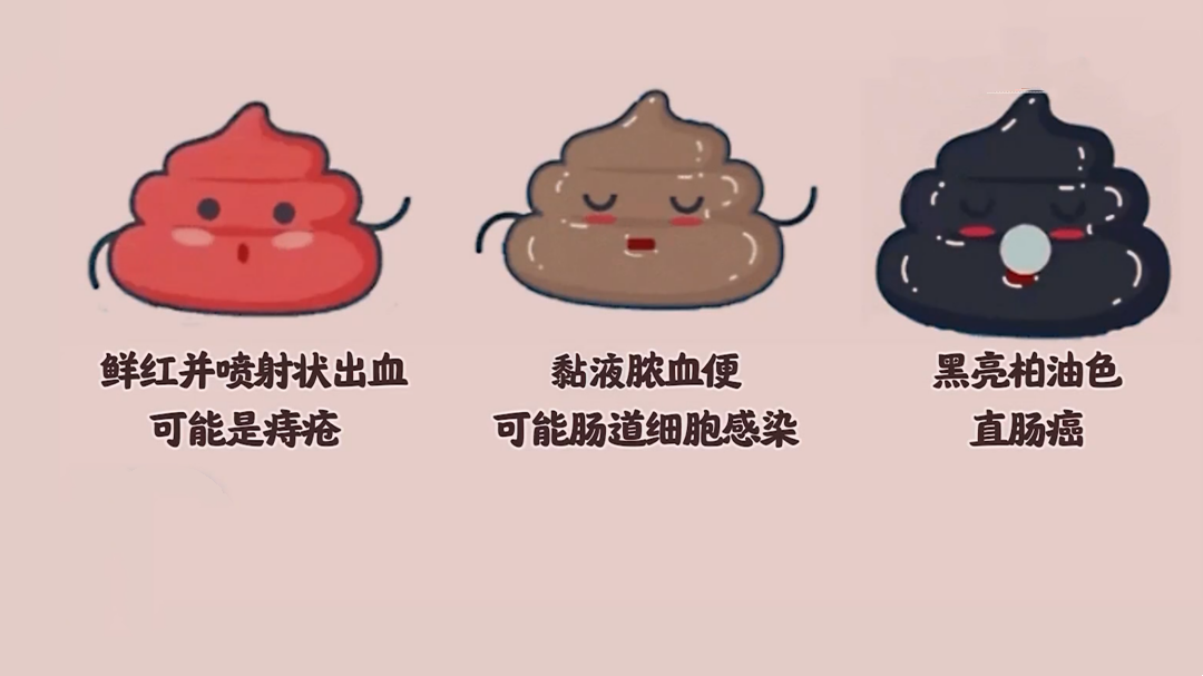 X诊所. 拖不得也忍不得的那些秋季“难言之隐”