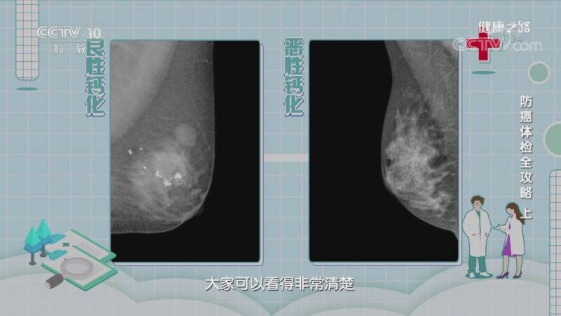 健康之路 《健康之路》 20200827 防癌体检全攻略（上）