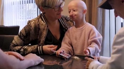 网罗天下 兄妹衰老比常人快5倍