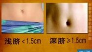 健康道 肚脐告诉你的健康问题