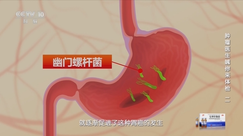 健康之路 《健康之路》 20230905 肿瘤医生喊你来体检（二）