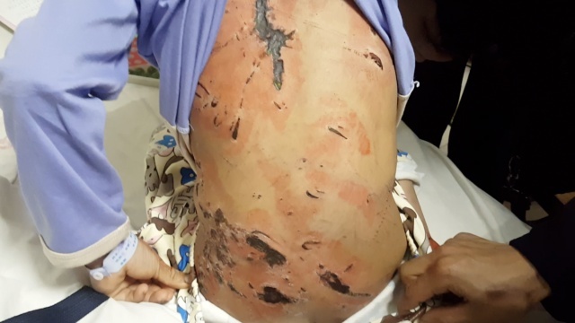 留守男孩被姑父皮带抽打,遍体鳞伤