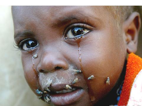 非洲贫困儿童 饥饿图片